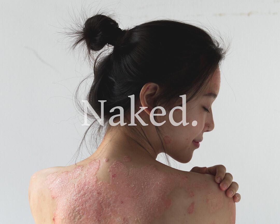 Instagram/rocyiewong Project Naked saved her life.